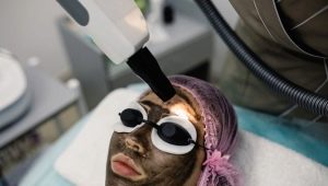 Carbon Peeling Rules