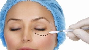 The process of conducting blepharoplasty of the lower eyelids