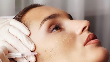 Bio reinforcement: what is it and how is it carried out?