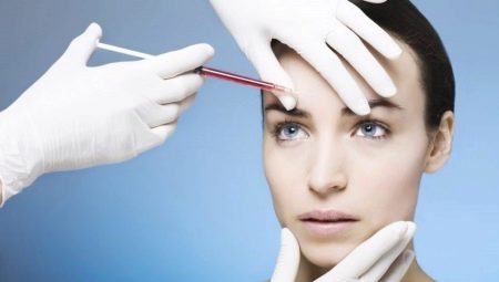 What is the procedure of plasmolifting of the face?