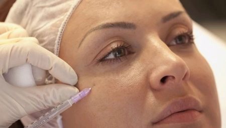 Mesotherapy of the face: what is it and how is it carried out?