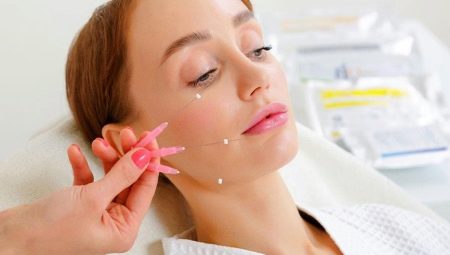 Facelift for facelift: característiques i regles d’ús