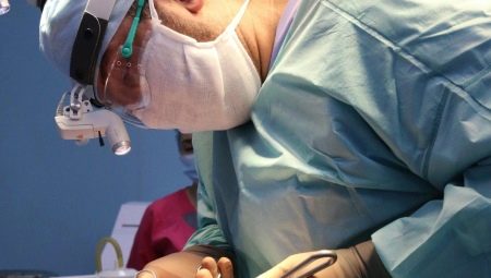 Features of the procedure for endoscopic face lifting