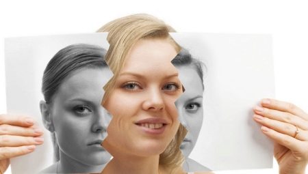 Cyclotility: characteristics and features