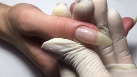 Features of building a broken nail