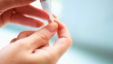 Ką daryti, jei lūžta nagas?