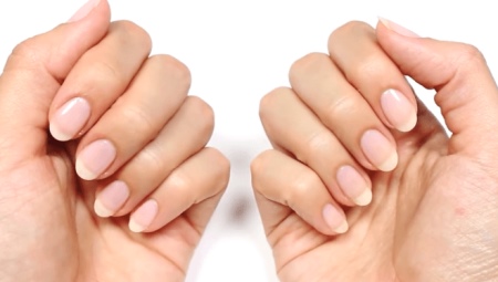Flaking nails: causes, treatment and prevention