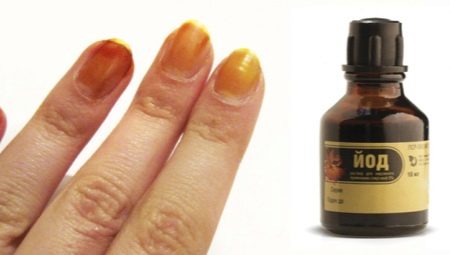 Nail iodine: from influence to use