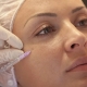 Mesotherapy of the face: what is it and how is it carried out?