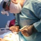 Features of the procedure for endoscopic face lifting