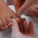 Toenails grow up: causes and treatment methods