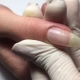 Features of building a broken nail
