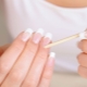 Nail matrix: description, structure and causes of damage