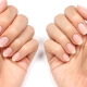 Flaking nails: causes, treatment and prevention