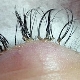 Unsuccessful eyelash extensions: causes and consequences